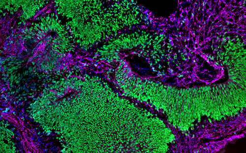 Brain organoid depicting neural stem cells (green) and neurons (magenta).