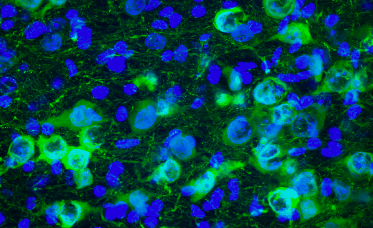 Blueprint for Neuroscience Research