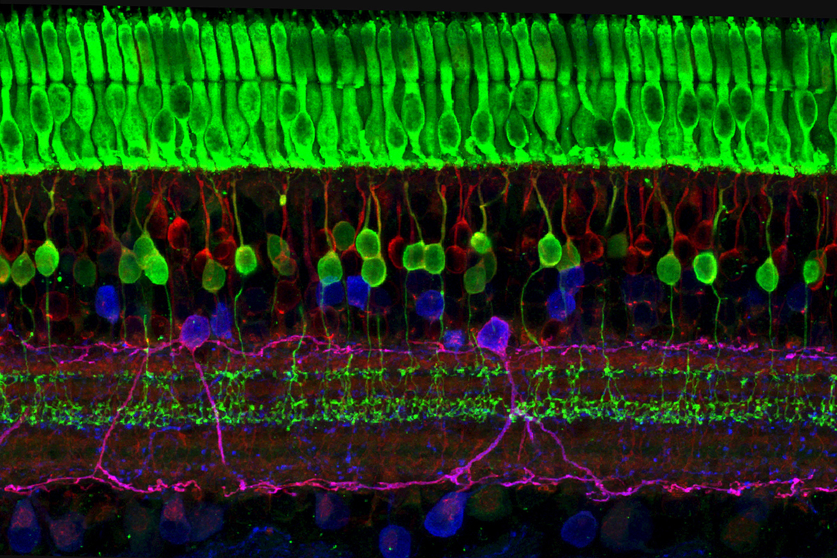 Image capturing the layers of nerve cells in the retina. The top layer (green) is made up of cells called photoreceptors that convert light into electrical signals to relay to the brain