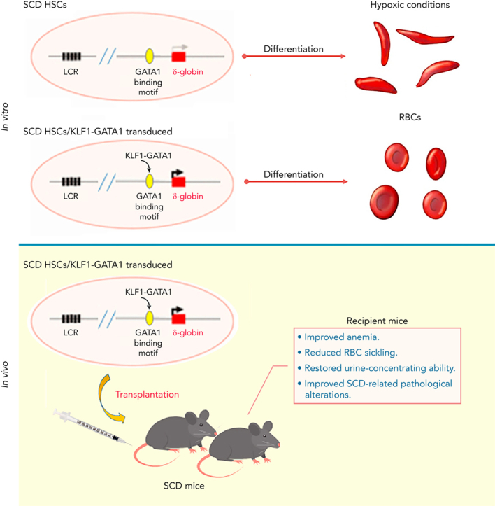 Process showing Kruppel-like factor 1–GATA1 fusion protein improving the sickle cell disease phenotype in mice both in vitro and in vivo. 