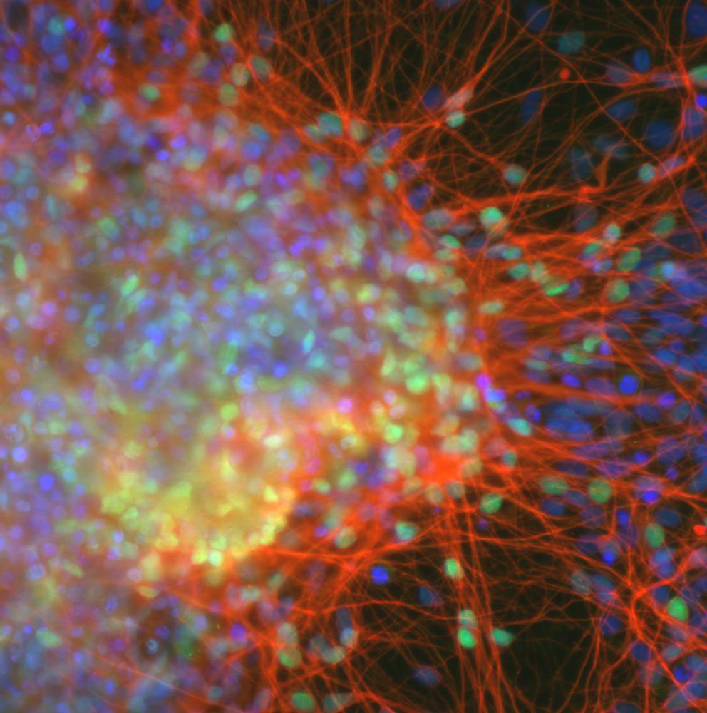 NIH Image Gallery National Institutes of Health (NIH)  Follow Cortical neurons derived from iPS cells.
