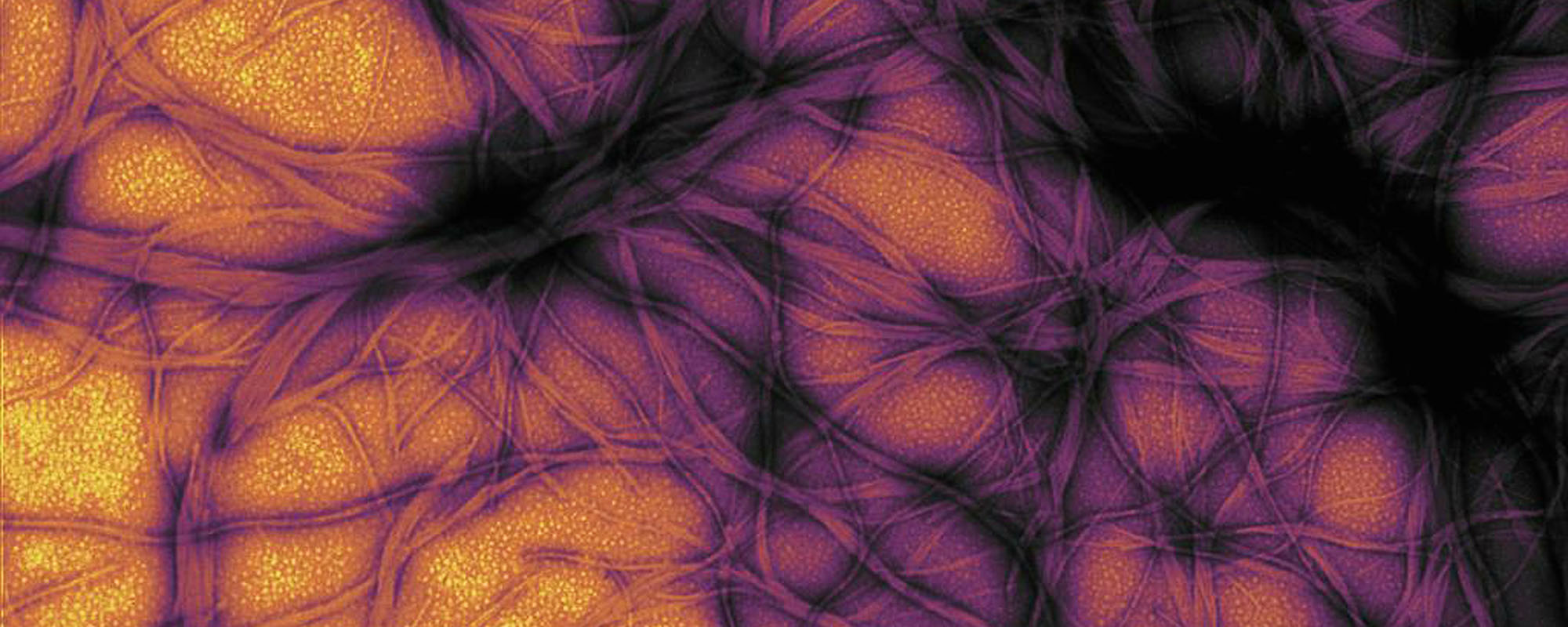 Colorized electron micrograph of prion protein fibrils