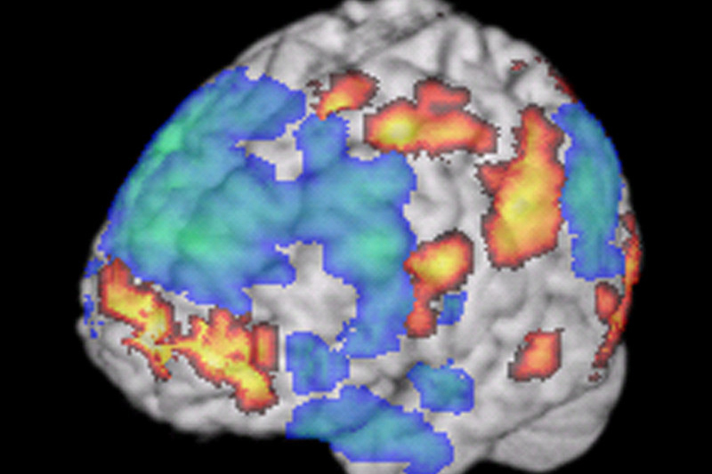 Brain image from a functional MRI scan when a person was listening to improvised jazz music