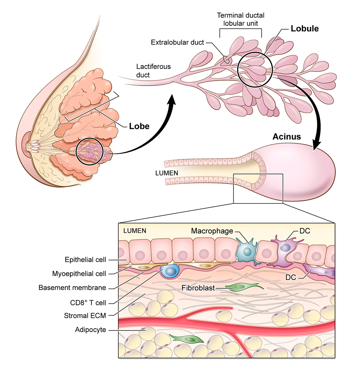 Breast lobular ductal unit