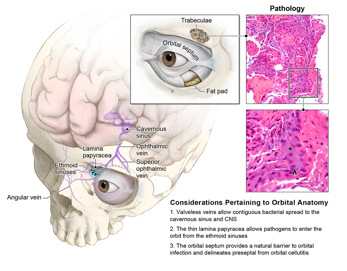 Orbital anatomy