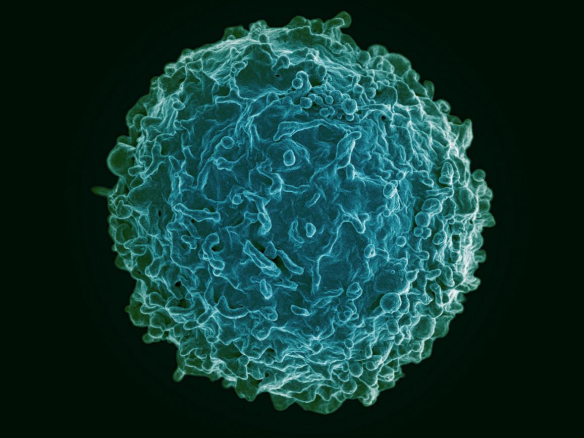Colorized scanning electron micrograph of a B cell from a human donor