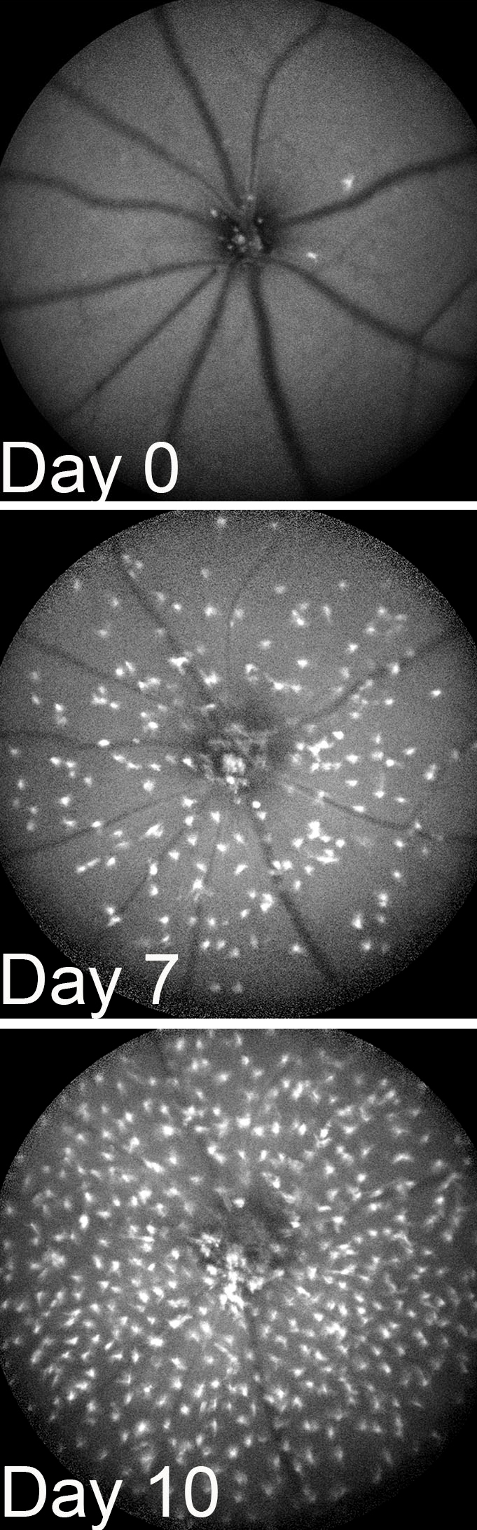 20180320-microglia-mouse.jpg