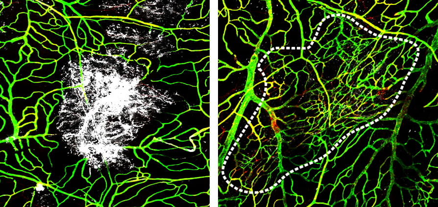 20180416-blood-vessels.jpg