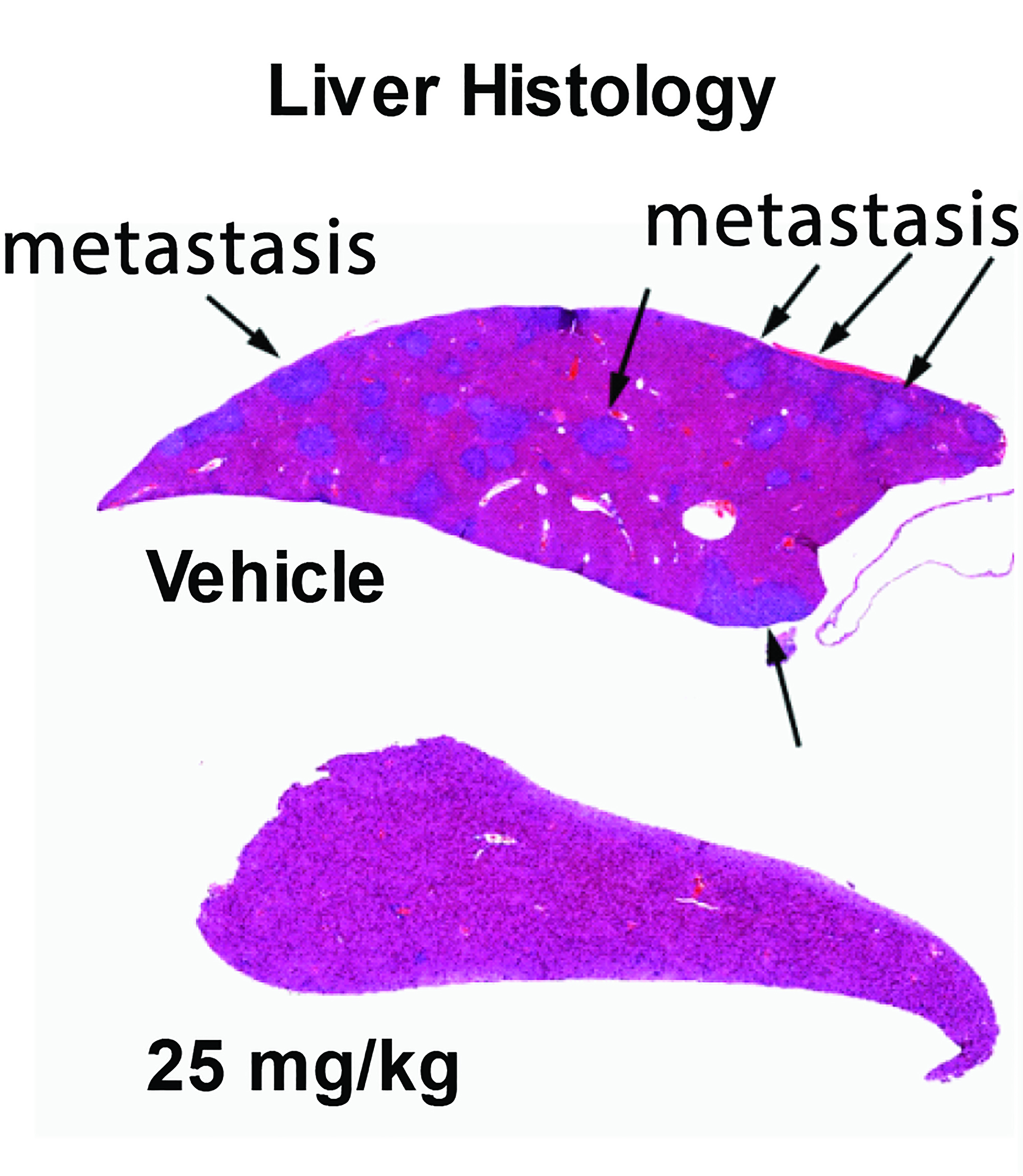 20180516-liver.jpg