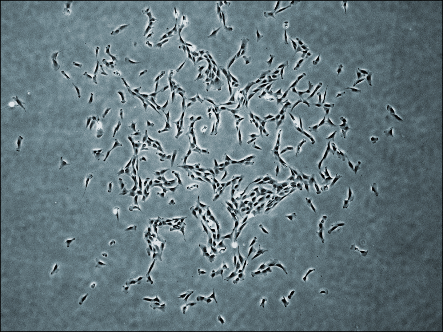 20181002-skeletal-cell.jpg
