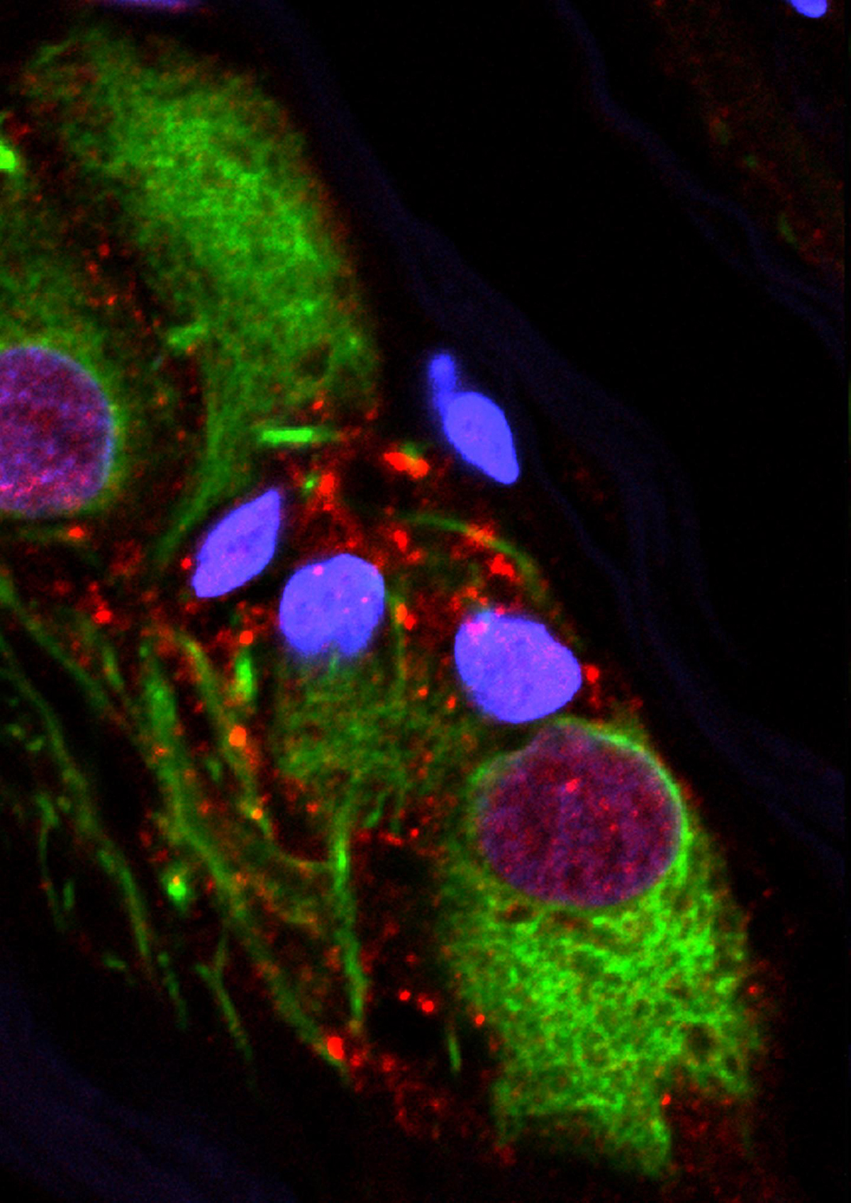 20181120-appendix-alpha-synuclein.jpg