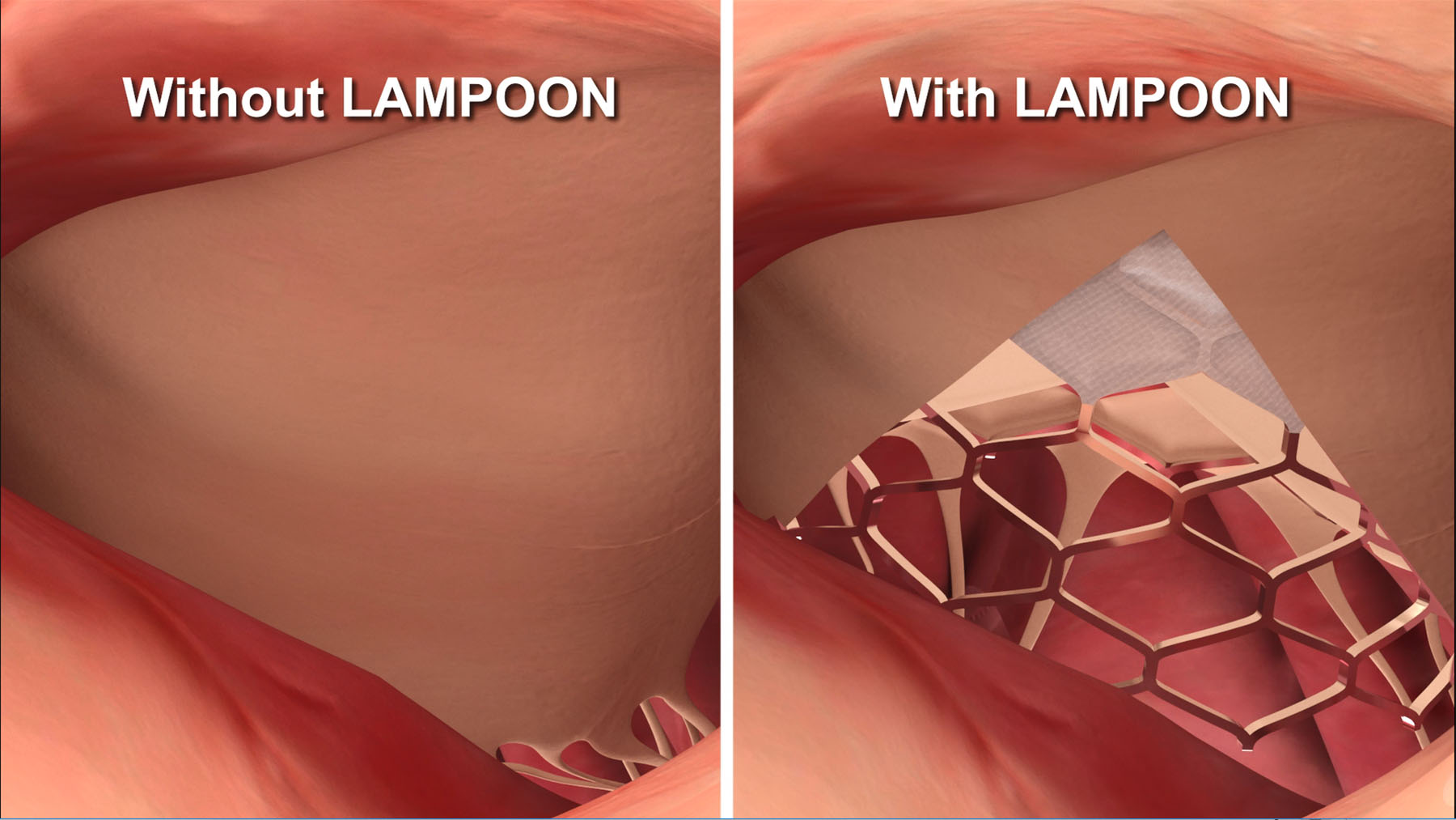 20190520-lampoon.jpg