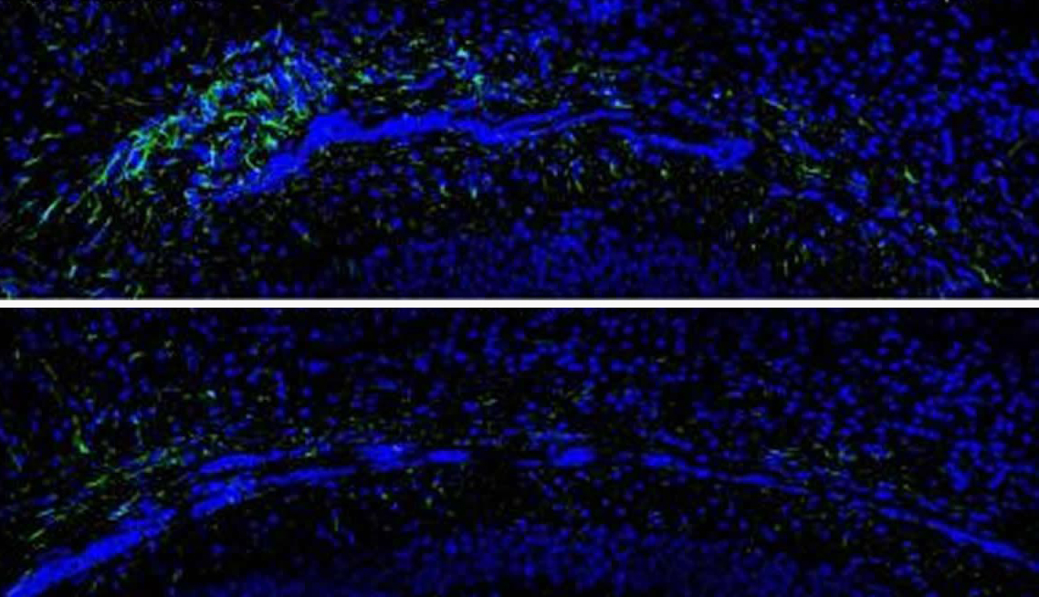 20190910-stuttering-neurons.jpg