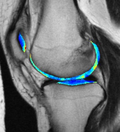 20201006-knee.jpg