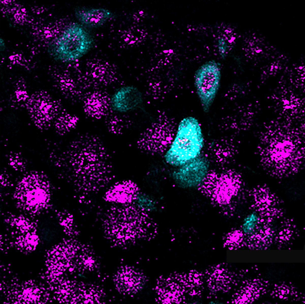 20201019-bladder-2.jpg
