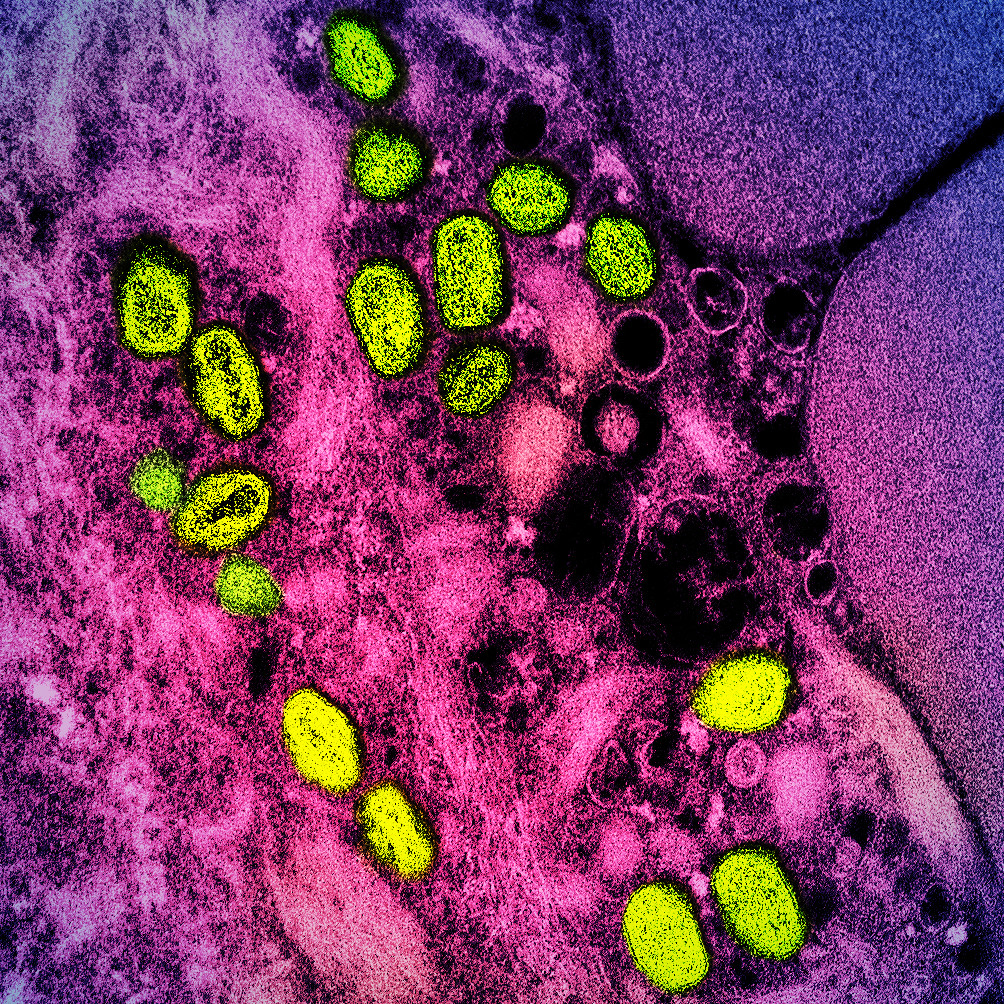 20220908-monkey-pox.jpg