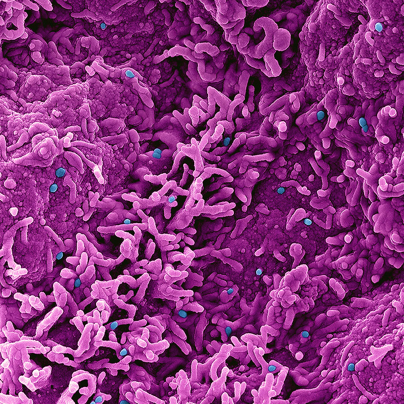 20220909-monkeypox.jpg