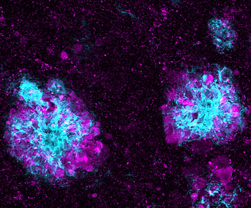 20240130-lysosome.jpg