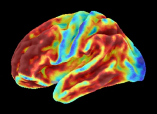 20240131-brain.jpg