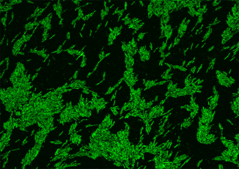 20240416-cholesterol-paper-orig.jpg