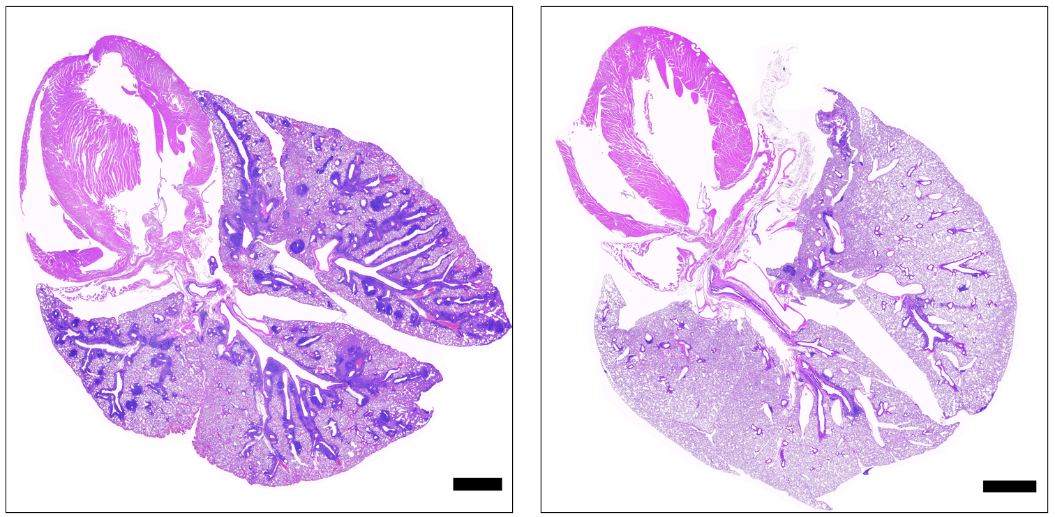 20240530-lung.jpg