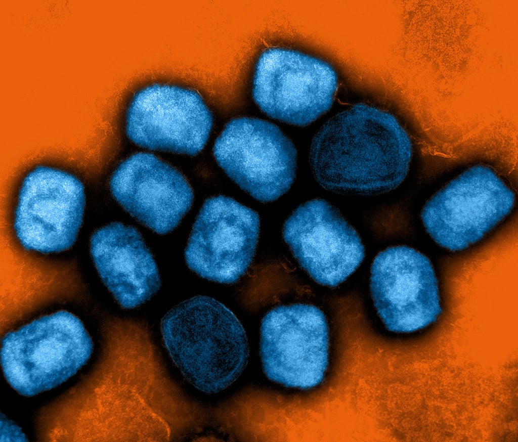 20240917-mpox.jpg