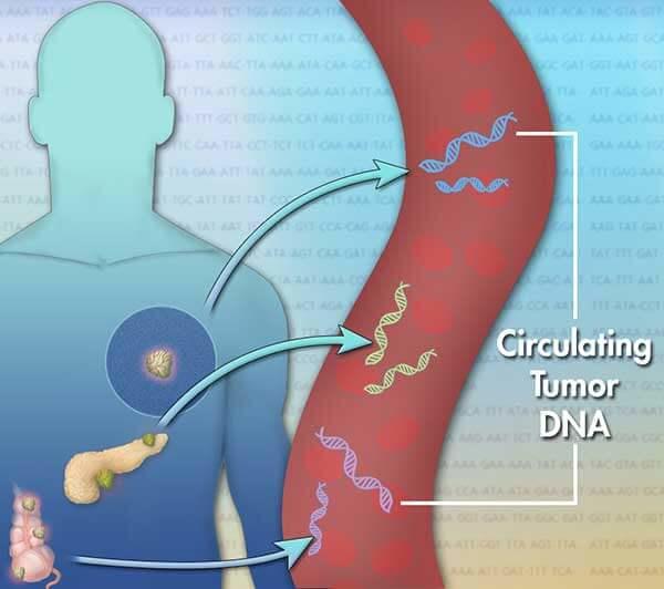 20250121-tumor.jpg