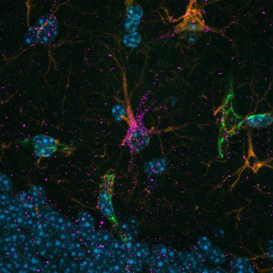 Astrocytes.
