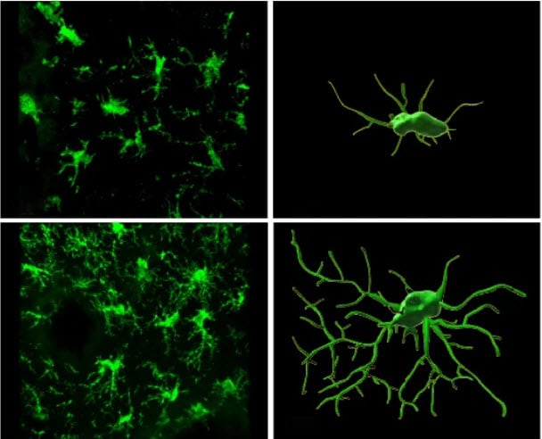 Image of cells in mouse brain. 