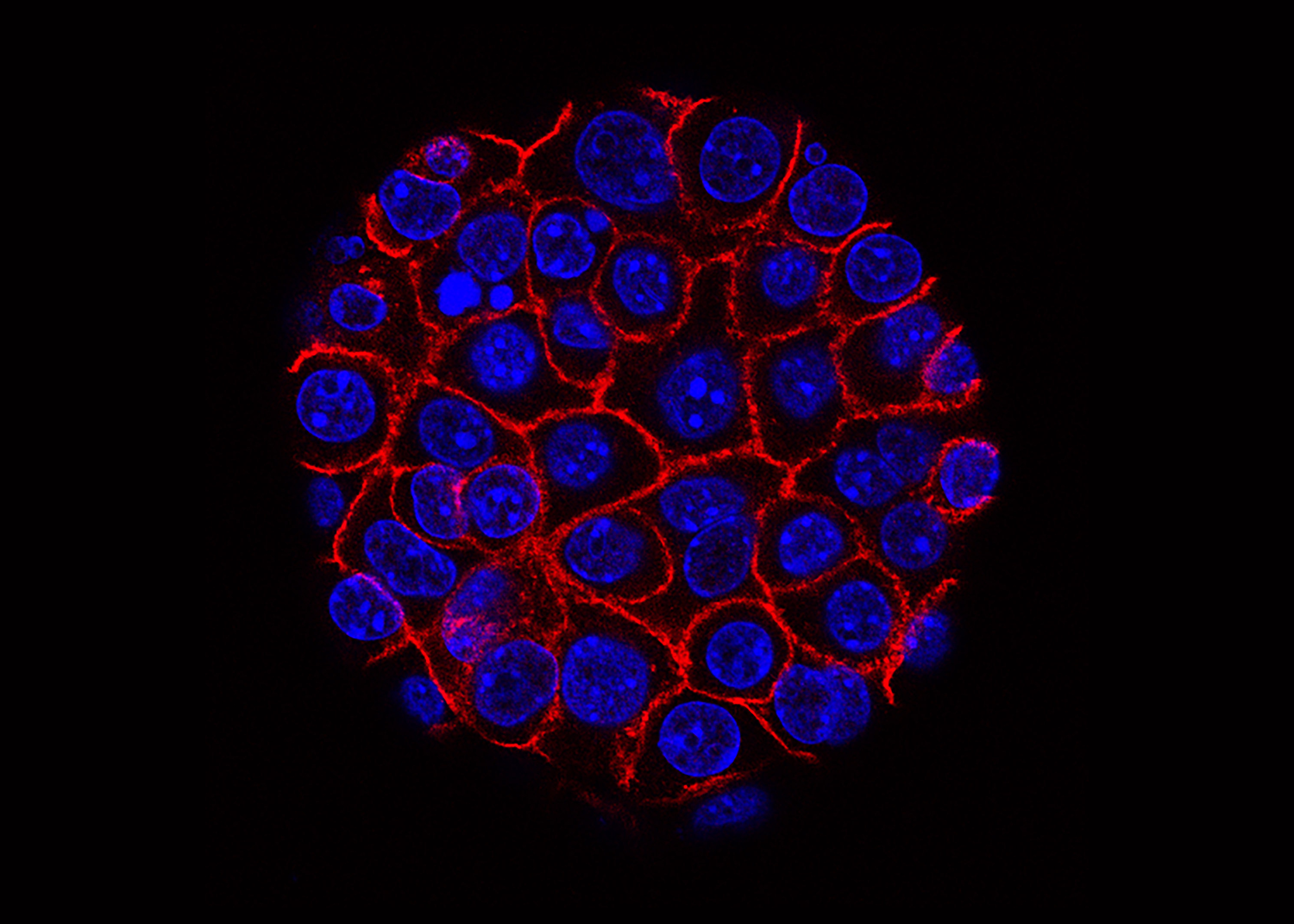 20260224-pancreatic.jpg