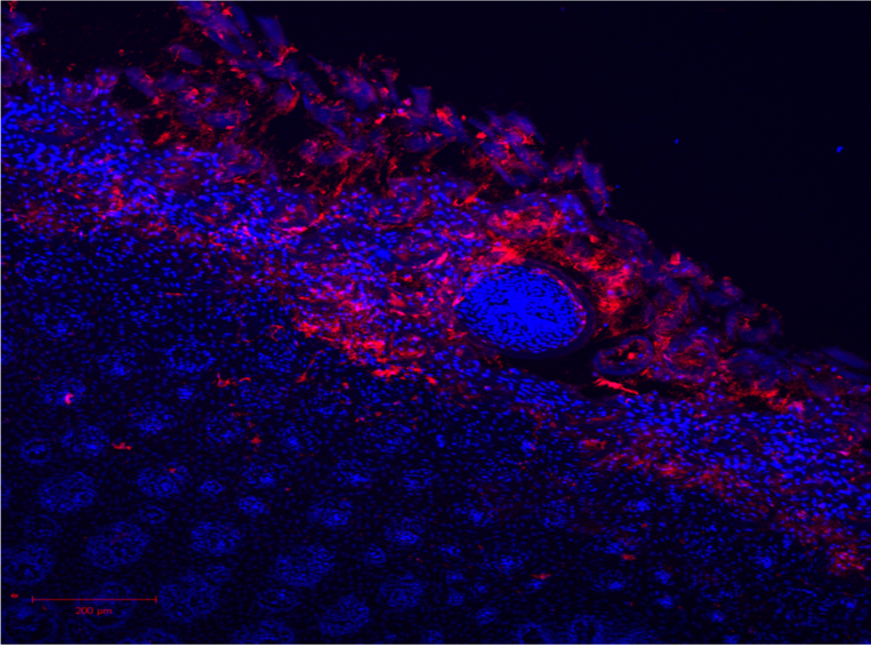 Nano-particles permeating topically into the tongue tissue.