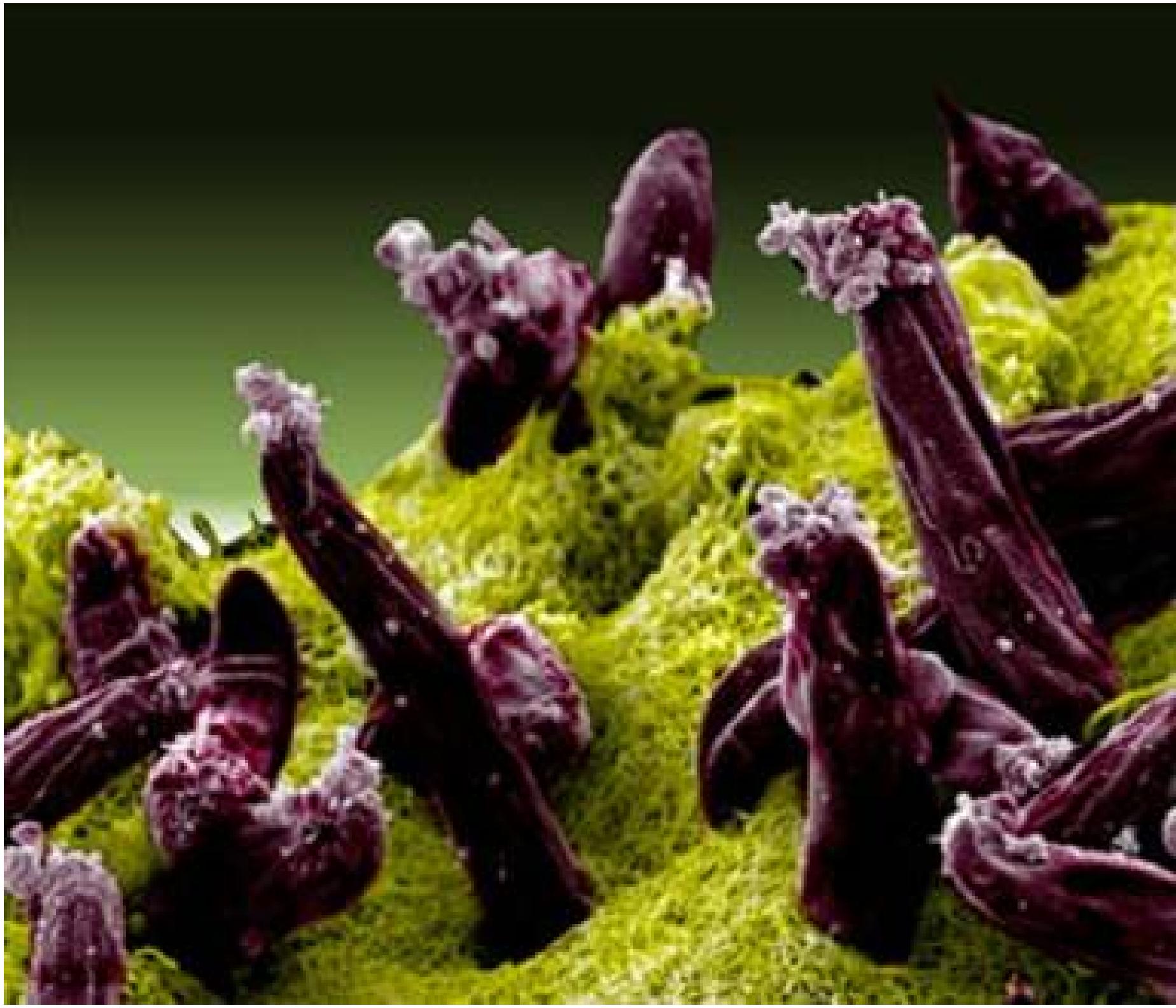 Malaria: Plasmodium gallinaceum