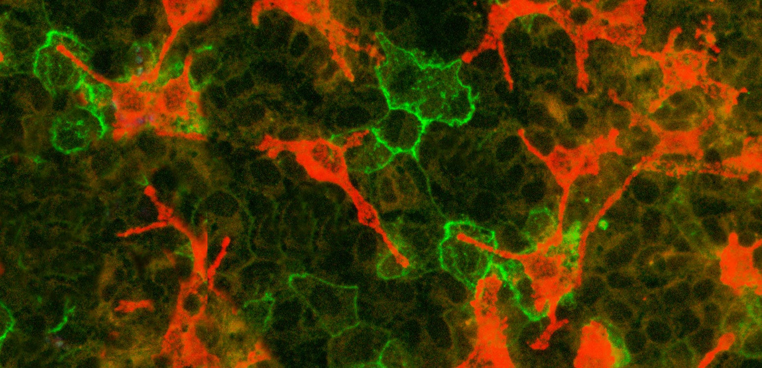 Tissue stain