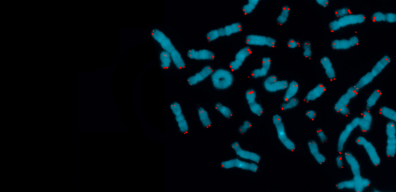Chromosomes