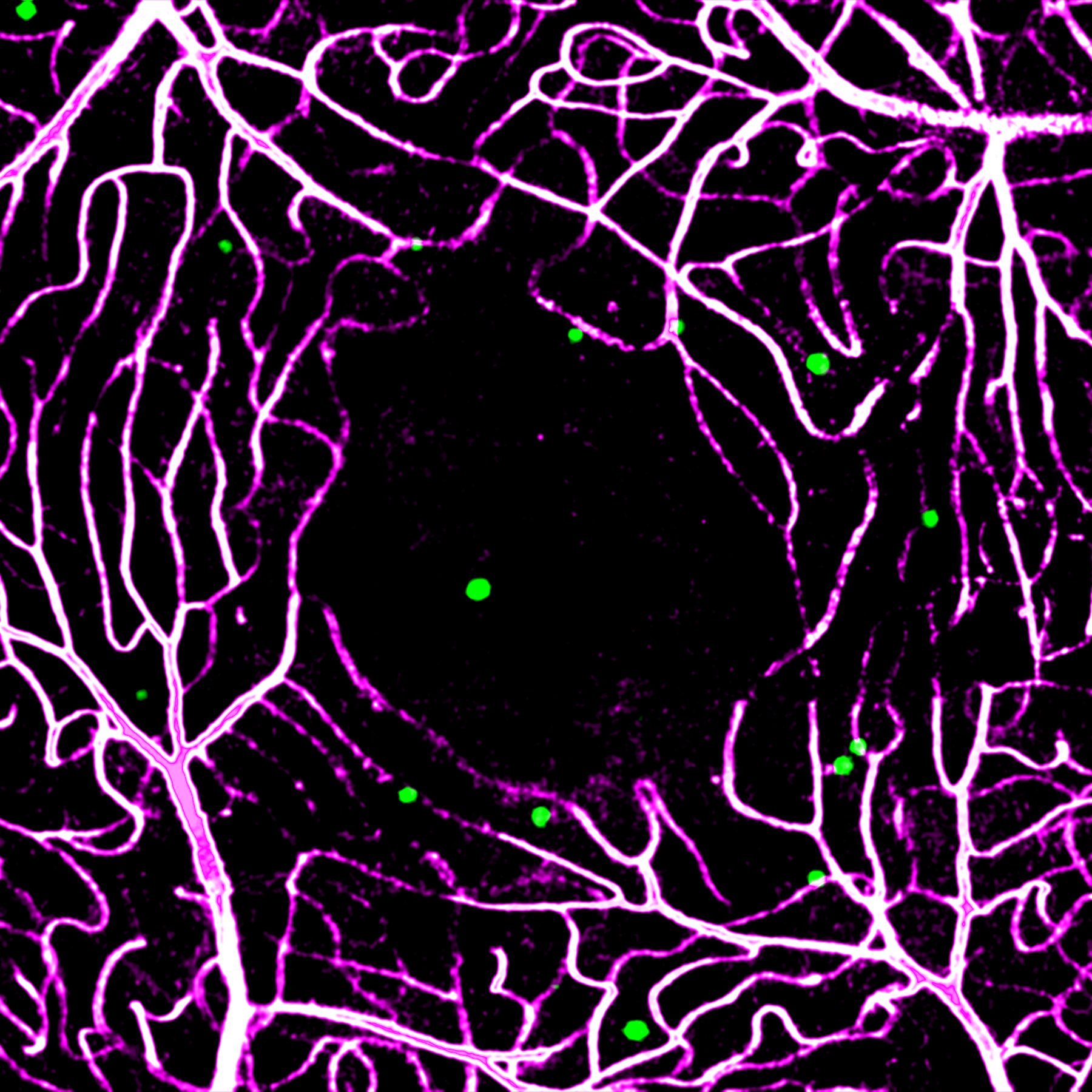 Erythrocytes in stasis captured within the choriocapillaris (green) and overlying parafoveal retinal capillaries (magenta). Read the associated publication.