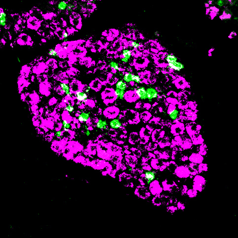 Nerves in dorsal root ganglion.