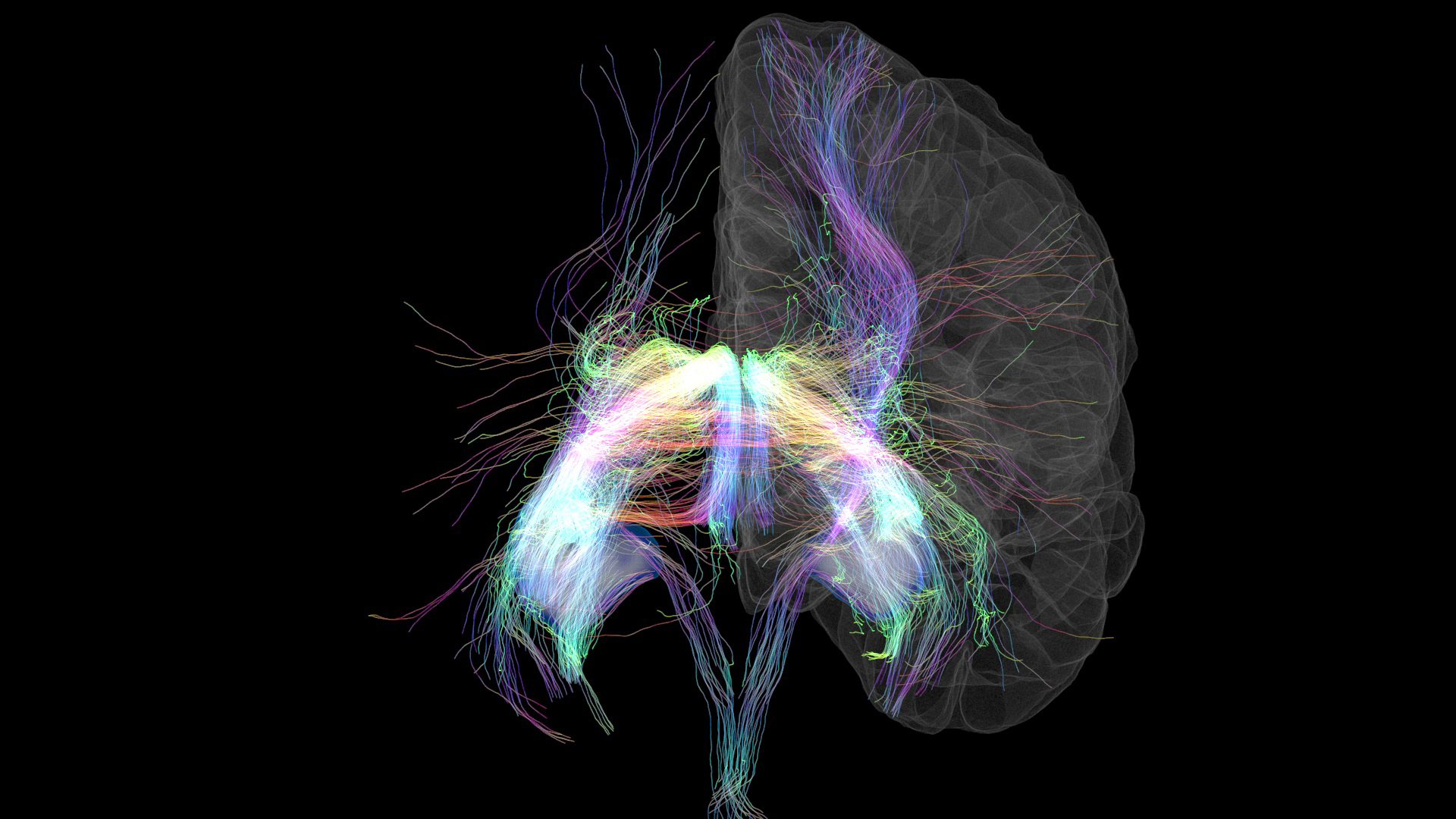 Memory Lanes. Third Place Photo Winner 2023. A rendering of MRI data –combining cortical surface and hippocampal segmentations from a T1 weighted scan and diffusion tractography.