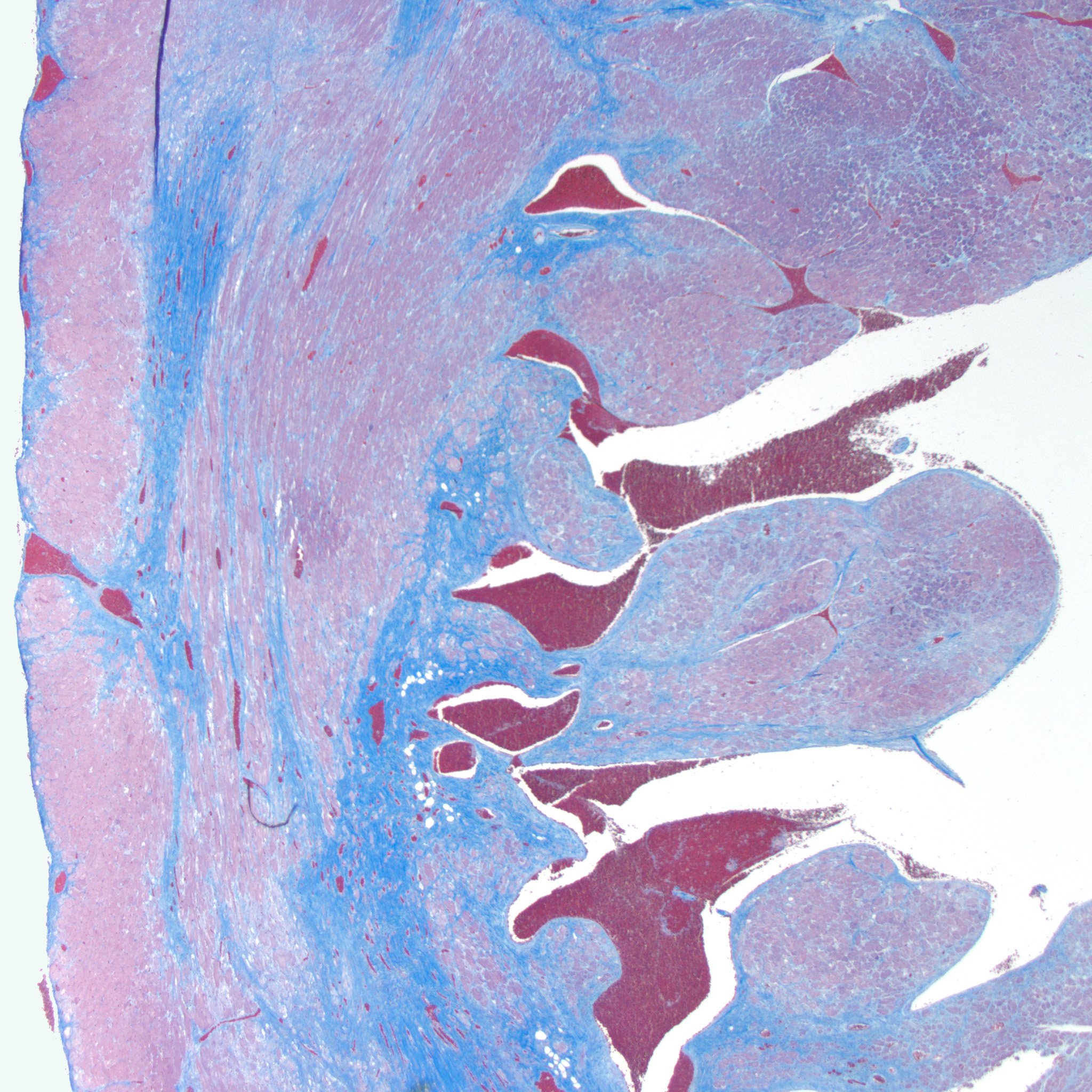 Callitrichid Trichrome Heart