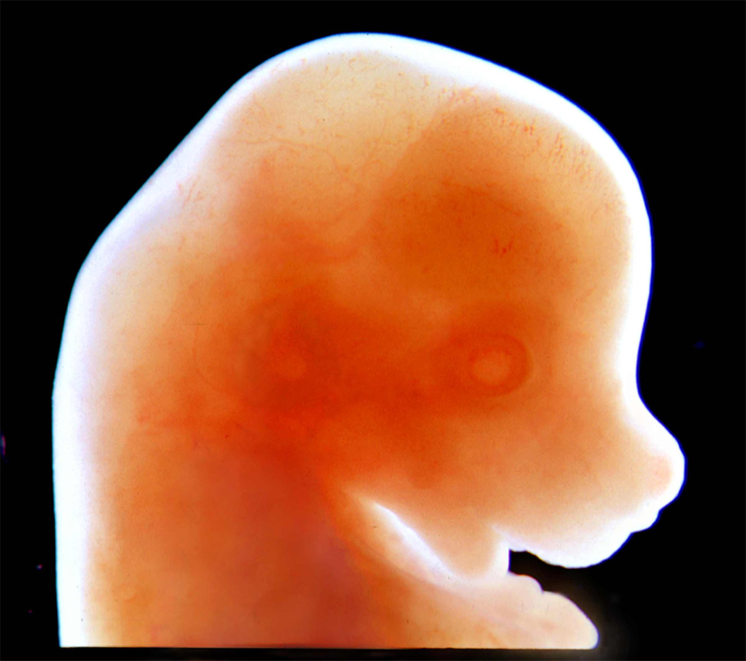 Craniofacial region of mouse embryo.