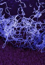 Microscopy photo of the Ebola virus.