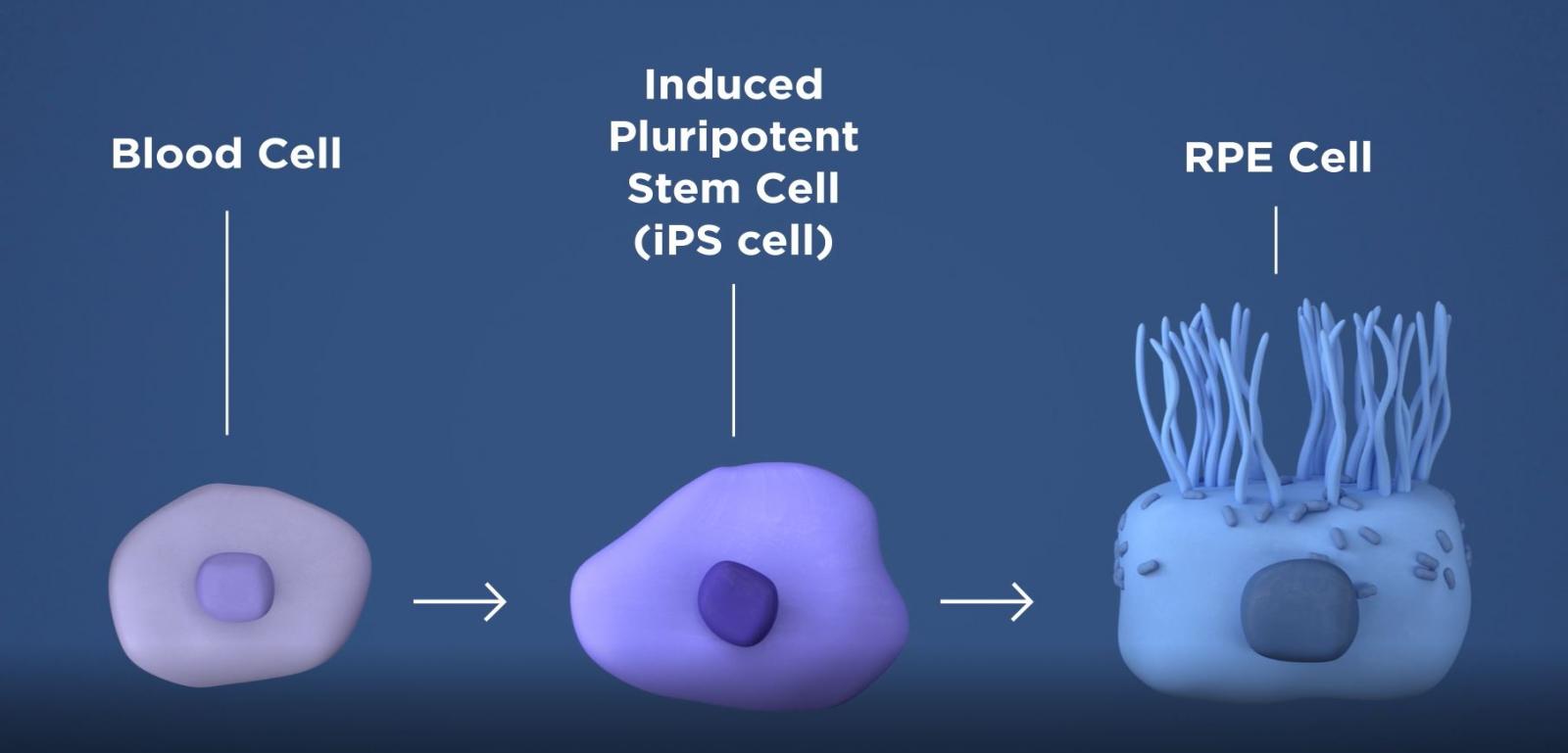 image explaining how iPSC works