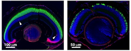 Cross-section of zebrafish eye