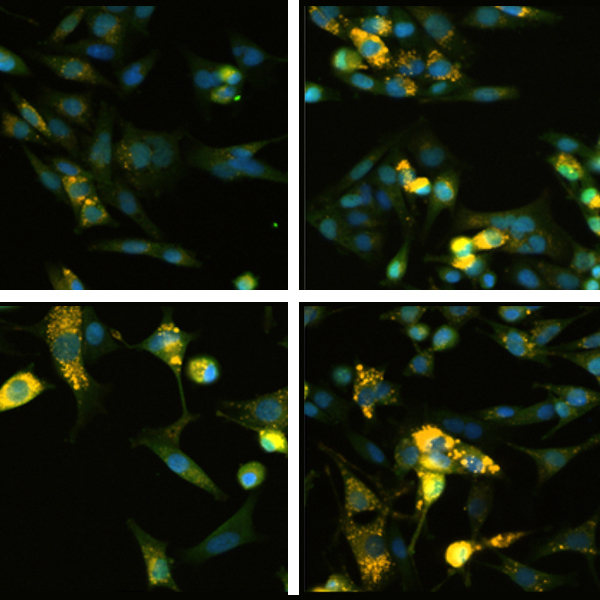 The effects of compounds on melanoma cells.