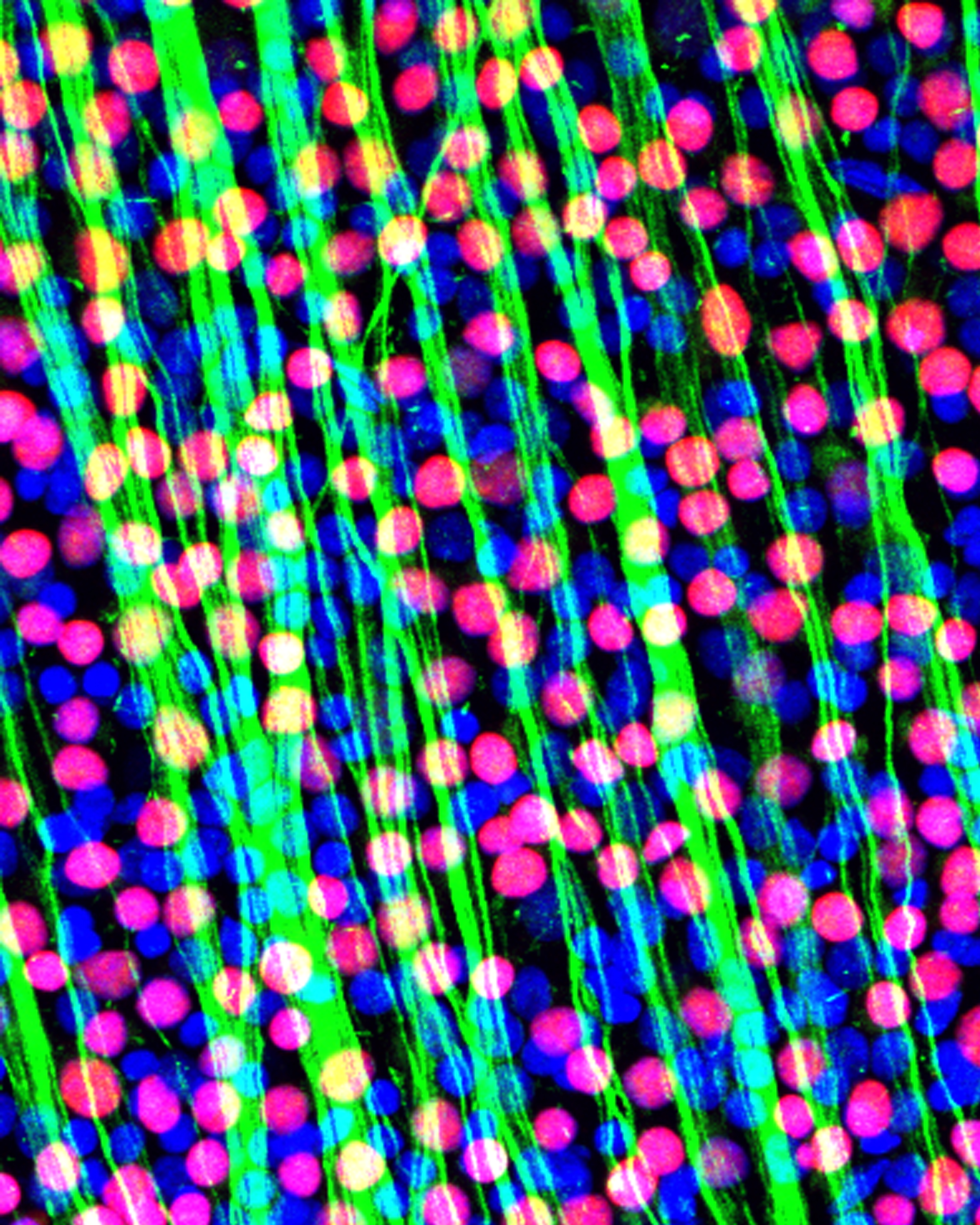 Fluorescent image of retinal cells