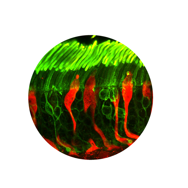 Photo of retinal cell