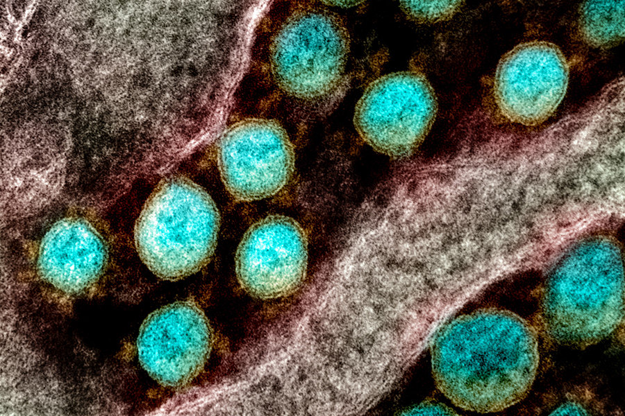 Transmission electron micrograph of SARS-CoV-2 virus particles.