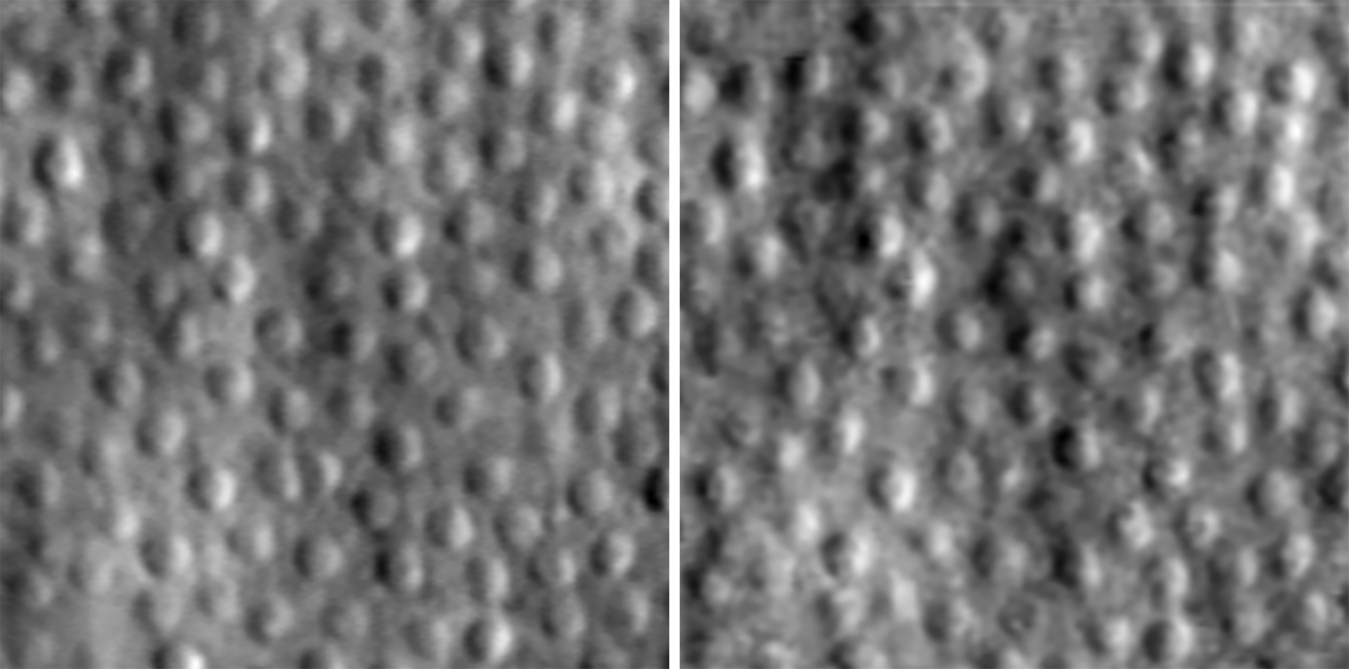 Cone photoreceptors imaged in a human eye 