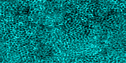 Retinal pigment epithelial cells imaged using artificial intelligence assisted imaging (P-GAN)