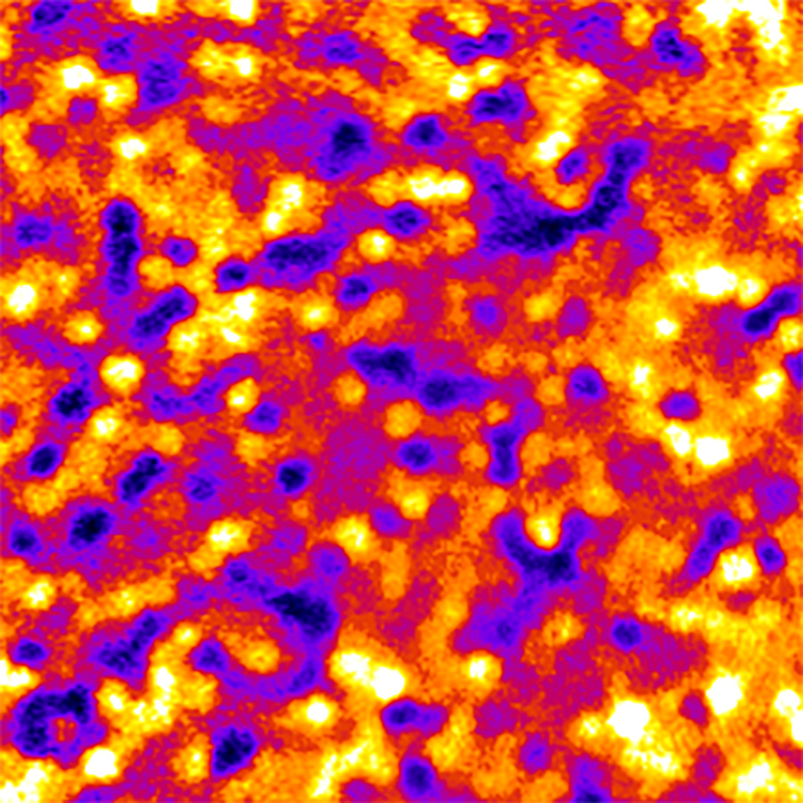 retinal pigment epithelial cells as seen by adaptive optics fluorescence microscopy