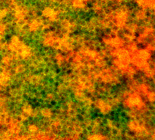 Retinal pigment epithelial cells imaged  using adaptive optics